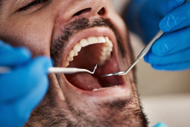 Best Emergency Wisdom Teeth Removal in Bradley Gardens, NJ